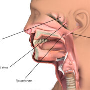 Nazofarenks Kanseri